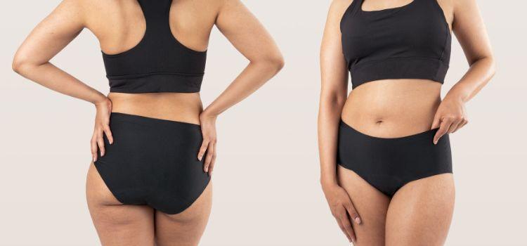 Vizeletcsepegés vagy menstruációs szivárgás?