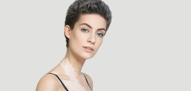 Bőrproblémák, melyek pajzsmirigygondokra utalhatnak