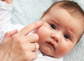 Hogyan kezelhető az ekcéma az arcon? Mutatjuk a lehetőségeket!