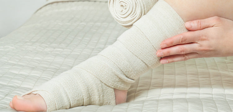 Mit tehetünk lábszárfekély esetén?