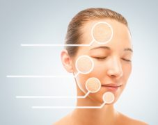 5 esztétikai probléma - 5 megoldás homeopátiával
