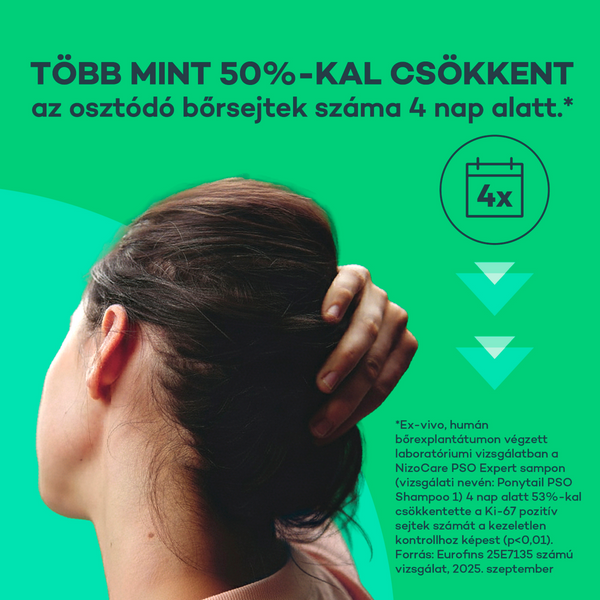 NizoCare PSO EXPERT sampon érzékeny, pikkelysömörre hajlamos fejbőrre 200ml - Kép 7