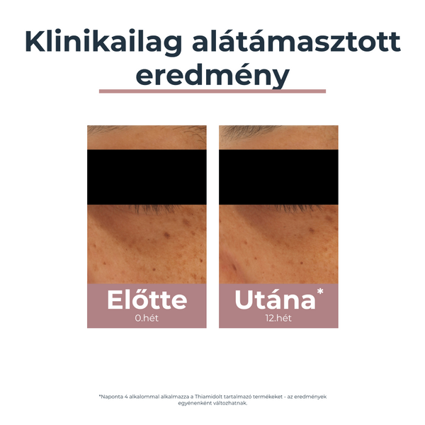 Eucerin Anti-Pigment szemránckrém 15ml - Kép 6