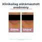 Eucerin Anti-Pigment szemránckrém 15ml - Kép 6